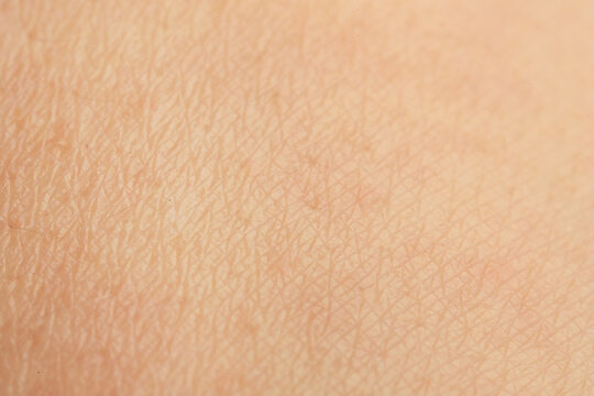Texture of dry skin as background, macro view