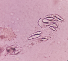 Giardia lamblia cysts and Trophozoite form, muscle fiber in stool examination, under 40X light microscope, selective focus.