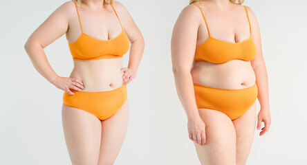 Tummy tuck, woman's fat body before and after weight loss and liposuction on gray background, plastic surgery concept - 745106237