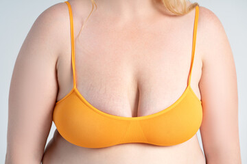 Large natural saggy breasts with stretch marks after breastfeeding in a top bra, big boobs...