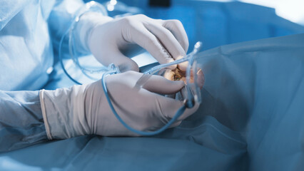 Open eye. Patient under sterile cover. Close-up. Laser vision correction. Patient and surgeon in...