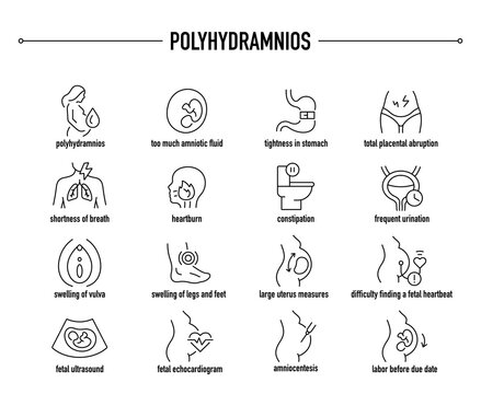 Polyhydramnios symptoms, diagnostic and treatment vector icons. Line editable medical icons.