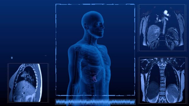 Magnetic resonance tomography  scan in different projections of the human digestive system. Anatomically accurate 3d render animation of the gallbladder
