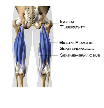 Hamstrings of superficial back line - biceps femoris, semitendinosus, semimembranosus, ischial tuberosity  