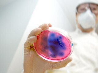 Lab worker with viral petri culture dish