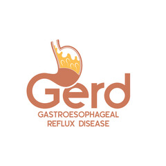 illustration of Gastroesophageal reflux disease or GERD.