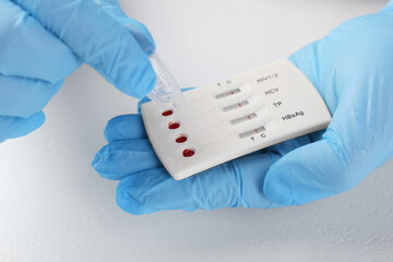 Doctor dropping buffer solution onto disposable multi-infection express test cassette at white...