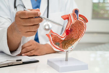 Stomach disease, doctor with anatomy model for study diagnosis and treatment in hospital.