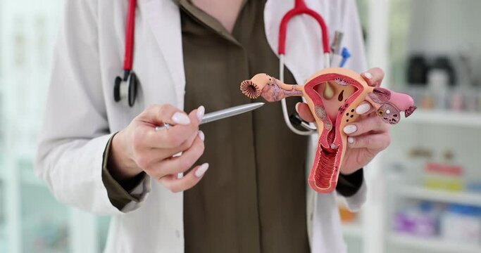 Gynecologist shows anatomical model of uterus in hand
