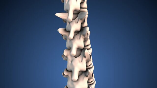 Human spinal disc pain medical concept