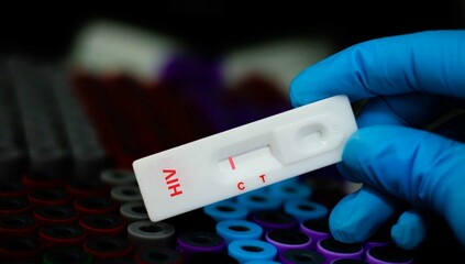 Blood sample of patient negative tested for anti-HIV by rapid diagnostic test.