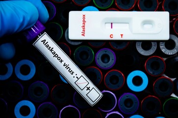 Blood sample of patient negative tested for alaskapox virus by rapid diagnostic test.