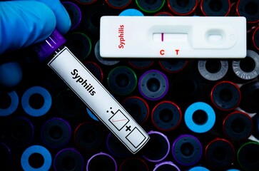 Fototapeta premium Blood sample of patient negative tested for syphilis by rapid diagnostic test.