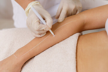 Laser epilation and cosmetology in beauty salon. Hair removal procedure. Laser epilation,...