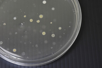 Colonies of bacteria growth on agar plate medium in laboratory.