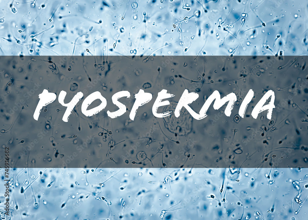 Sticker Pyospermia medical term, a high number of white blood cells or puus cell in semen. It can weaken sperm and affect fertility