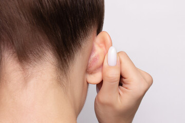 Close-up of a woman's head with dandruff behind the ears, rear view. Isolated on a gray background....
