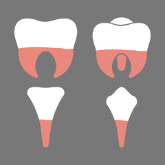 Molars, Premolars, Incisors and Canine Human Teeth Types Diagram for Education Purposes on Grey Background