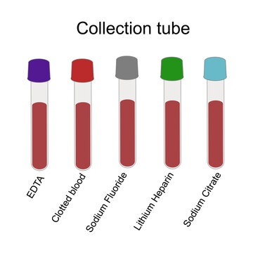The Type of blood collection tube for suitable testing : EDTA, Clotted blood, Sodium Fluoride, Lithium Heparin and Sodium Citrate tube in the cap color: purple, red, gray, green and light blue.