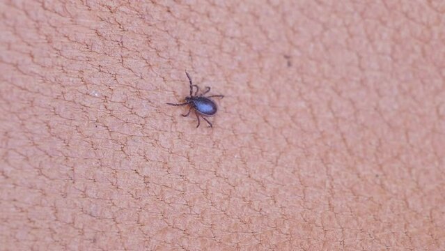 parasite tick, mite from order Ixodidae, blood-sucking parasites crawls on skin, Acariformes, carrier of dangerous disease encephalitis, surveillance systems, tick-borne disease prevention strategies