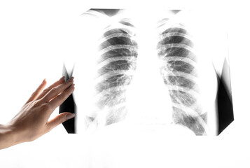 A snapshot of the lungs. Fluorography. X-ray shows lungs with pneumonia. Chest x-ray into the lumen on a white screen. Ribs and lungs in x-ray. Coronavirus. A symbol of a healthy lifestyle.