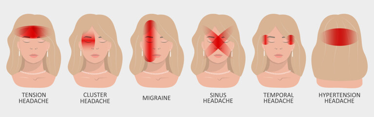 Vector illustration of a girl having a headache. Localization and types of headaches. Neurology and medicine.