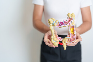 Woman holding human Colon anatomy model. Colonic disease, Large Intestine, Colorectal cancer, Ulcerative colitis, Diverticulitis, Irritable bowel syndrome, Digestive system and Health concept - obrazy, fototapety, plakaty