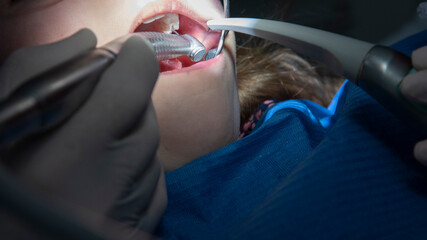dentist while he is treating a caries to a patient