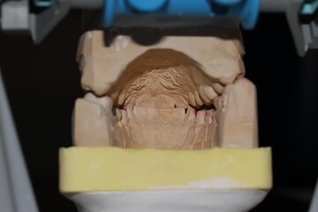 dental technician model fixed prosthesis ceramic wax up plaster crown ceramo ceramic CCM