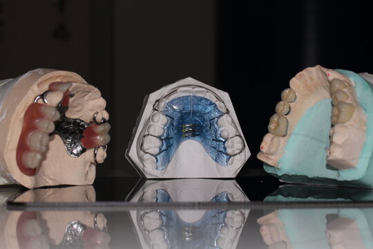 dental technician model orthosis resin wax tooth  removable prosthesis PAPM cobalt chrome resin wax tooth denture frame  fixed prosthesis ceramic wax