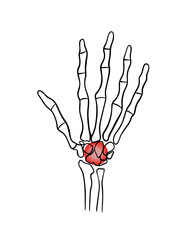 Vector isolated illustration of wrist pain. Hand with localization of pain in the wrist.