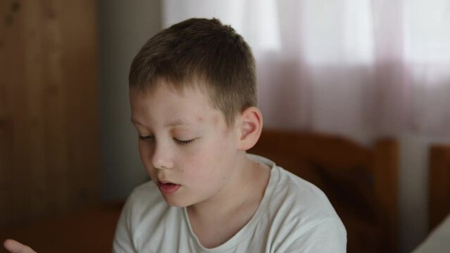 Portrait of caucasian boy with series of red bites on his face. Child with allergic reaction to insect bites and swollen eye plays on smartphone in childrens bedroom at home.