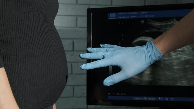 Woman rejecting from medical help. A pregnant woman reject the doctor hand to examine the belly.