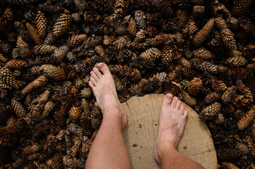 Man walks barefoot along a massage tactile eco-path made of pine cones, tree cuts in the park, foot massage, top view. Relieving stress, depression, reflexology. Hallux valgus, prevention
