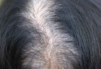 Senior aged asian woman concern about gray hair in menopause..