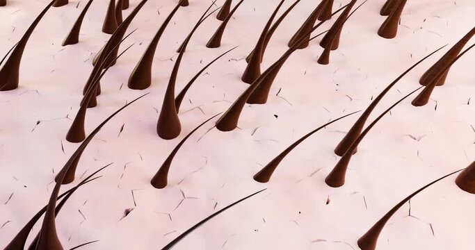 A 3D rendering of the blown-away keratinized layer of skin, leaving a clean layer of hairline behind. The animation shows the process of removing problematic skin and dandruff.
