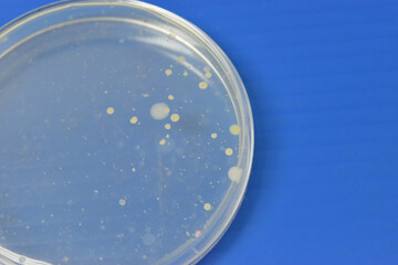 Colonies of bacteria growth on agar plate medium in laboratory.