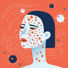 a woman with red spots on her skin, virus concept, disease prevention, chicken pox, measles, contagion