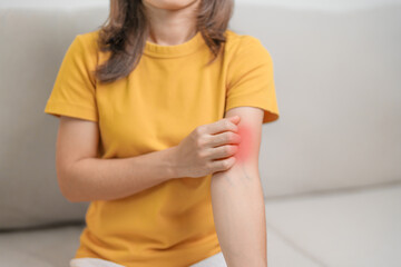 woman itching and scratching itchy arm. Sensitive Skin Allergic reaction to insect bite, food, drug dermatitis. Dermatology, Leprosy day, Systemic lupus erythematosus, Allergy symptoms and rash Eczema - obrazy, fototapety, plakaty