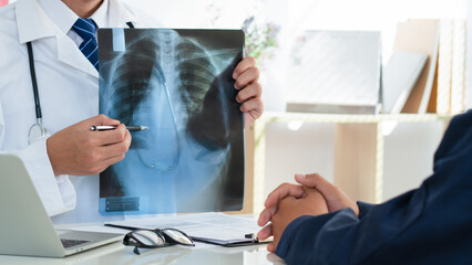 Doctor examining the patient chest x-ray film lungs scan in hospital. Lung problem. Lung Cancer or...