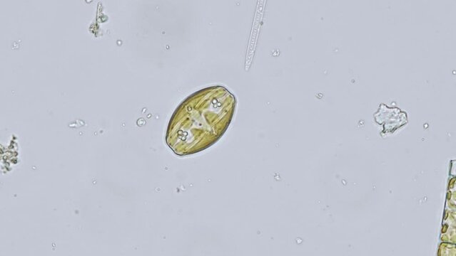freshwater diatom algae under the microscope - optical microscope x400 magnification