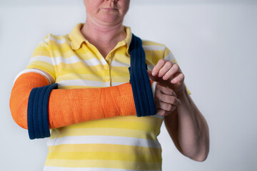 woman with a broken right arm in Fiberglass casts to hold broken bones in place until they heal, modern treatments,