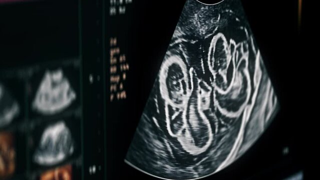 Echogram Images – Browse 24,734 Stock Photos, Vectors, and Video ...