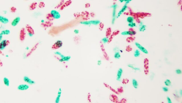 Euglena under microscope. Promising raw material for production of biodiesel and jet fuel. Growing demand for biofuels. 400 times magnification