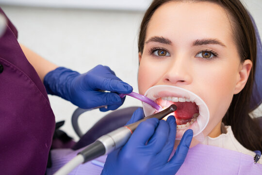 Young woman receiving caries treatment in a dentist clinic