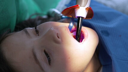 Laser dentistry - close-up child's mouth applying laser, little girl at Destic office