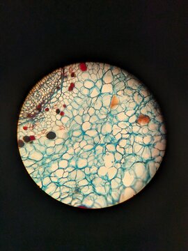 photo of tissue of Plasmopara viticola under the microscope