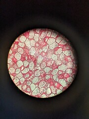 The Sporophyte of Pellia tissue under the microscope
