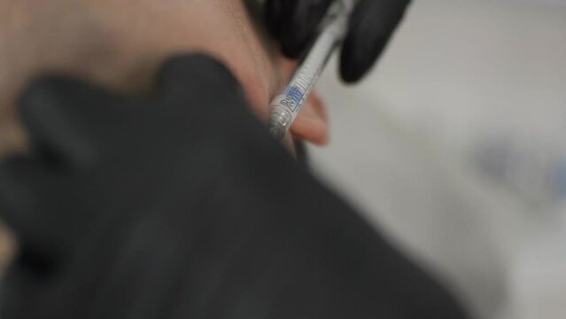Close-up. Syringe with a needle for injection under the skin of the face of men, tightening procedure. White matter. Beautician's black gloves