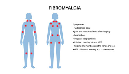 Fibromyalgia medical poster